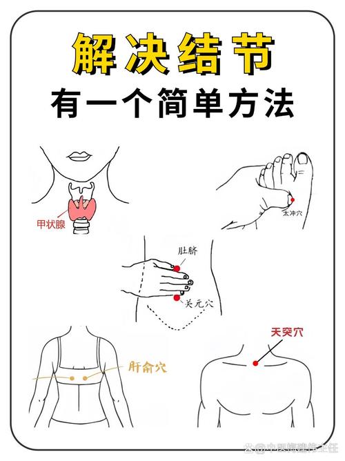 甲状腺针灸治疗的穴位