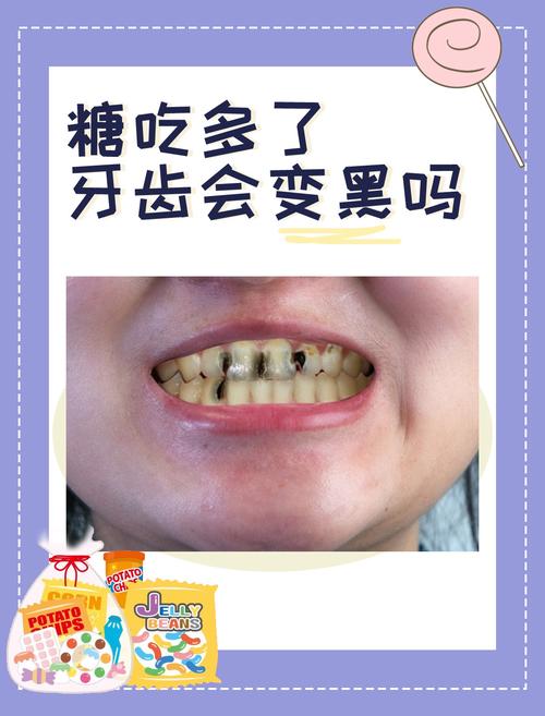 饮食 导致 牙齿 黑