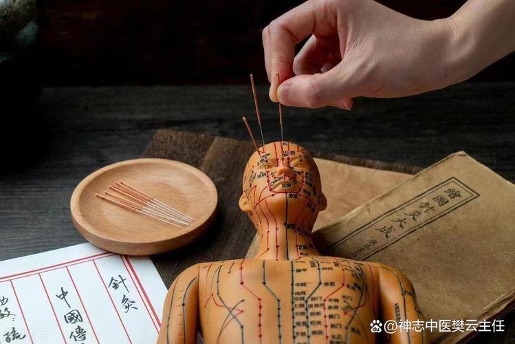 抑郁焦虑针灸什么穴位