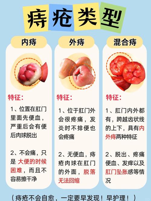 重庆中医院痔疮怎么样