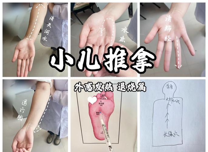 宝宝发烧按摩哪些穴位