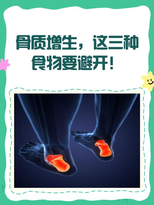 骨质增生患者饮食禁忌