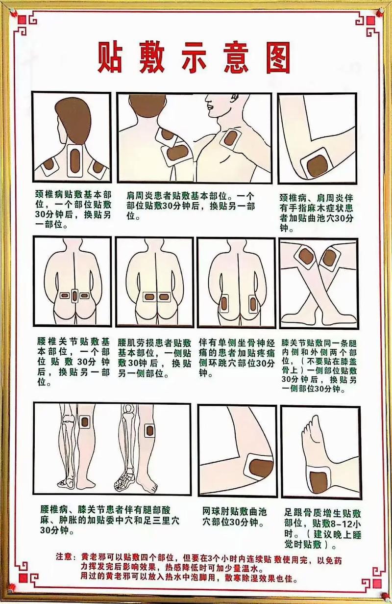 穴位贴敷技术操作流程