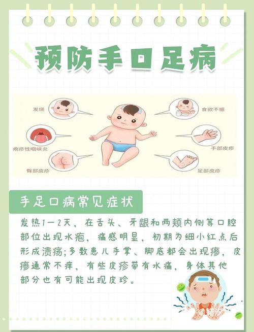得了手足口病饮食禁忌