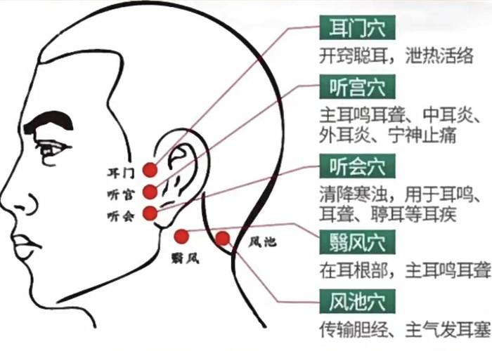 治耳鸣针刺那个穴位