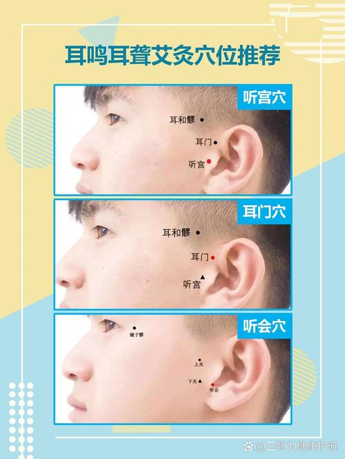 治耳鸣针刺那个穴位