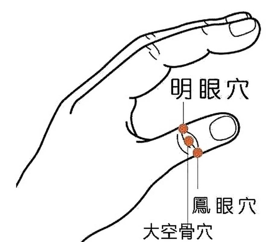 穴位治疗近视有效吗