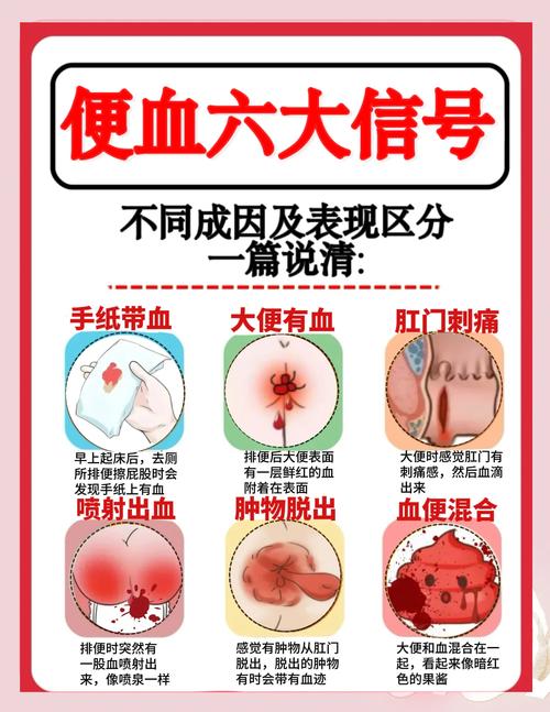 痔疮便血怎么注意饮食