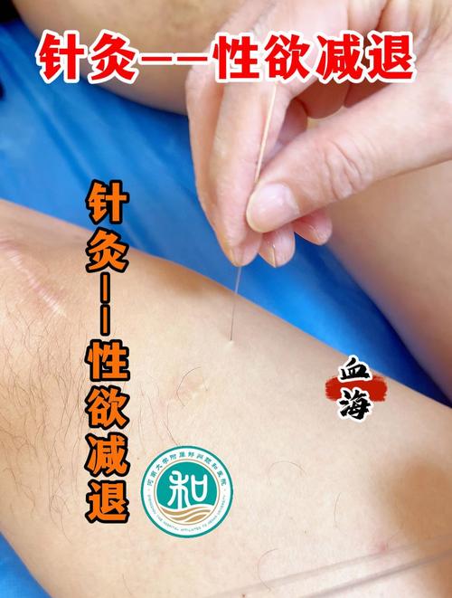 女性性冷淡针灸穴位