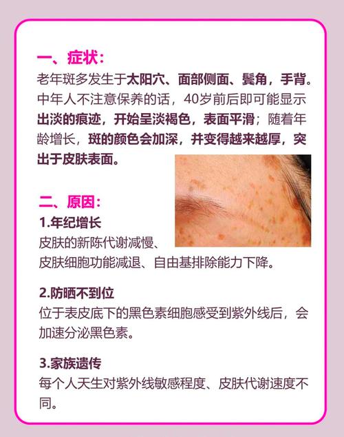 中医可以去脸上的斑吗