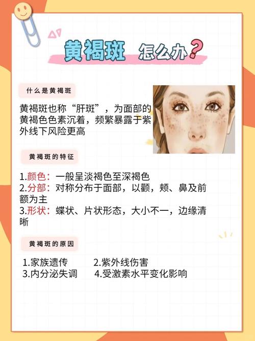 中医可以去脸上的斑吗