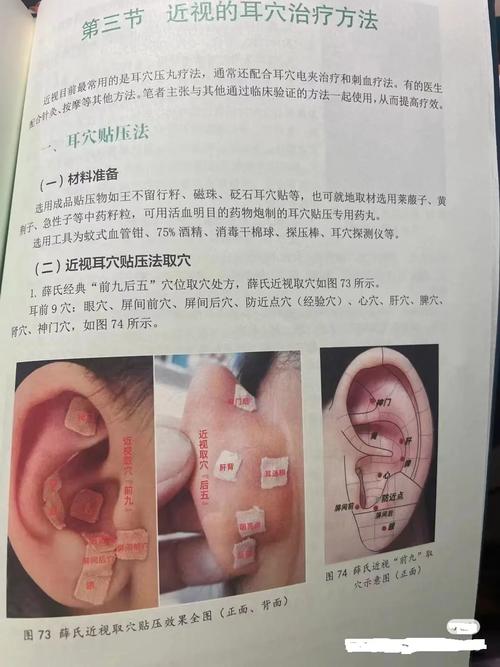 按耳朵穴位预防近视