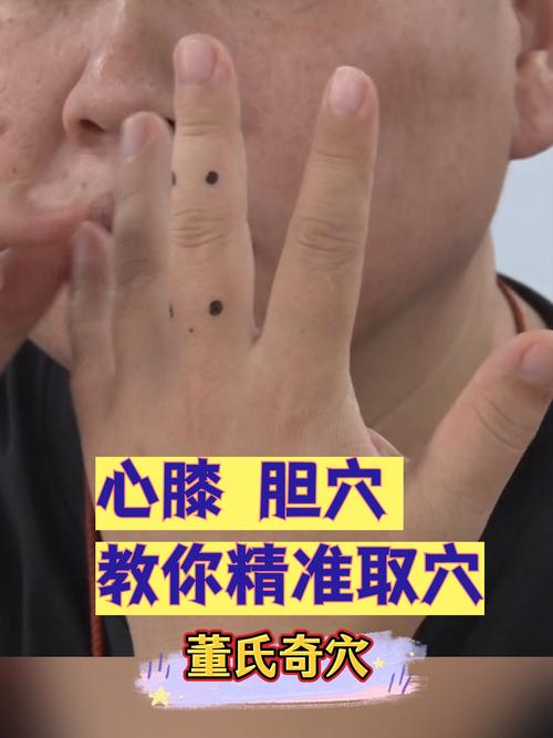 胆结石按压穴位止痛