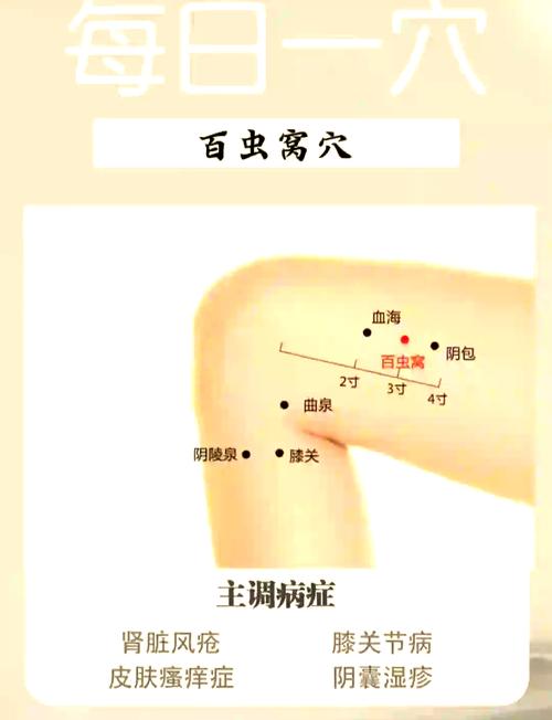 哪些穴位治皮肤湿疹