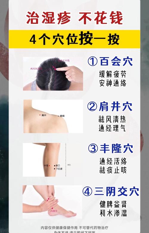 哪些穴位治皮肤湿疹