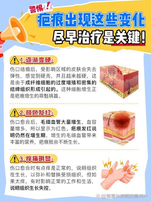 硬皮病有哪些饮食禁忌