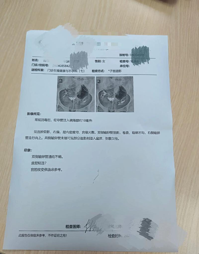 中医自检测输卵管图片