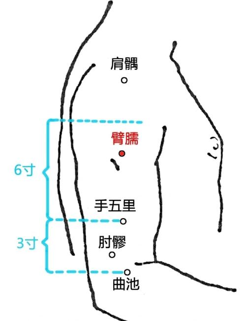 针灸胳膊有哪些穴位