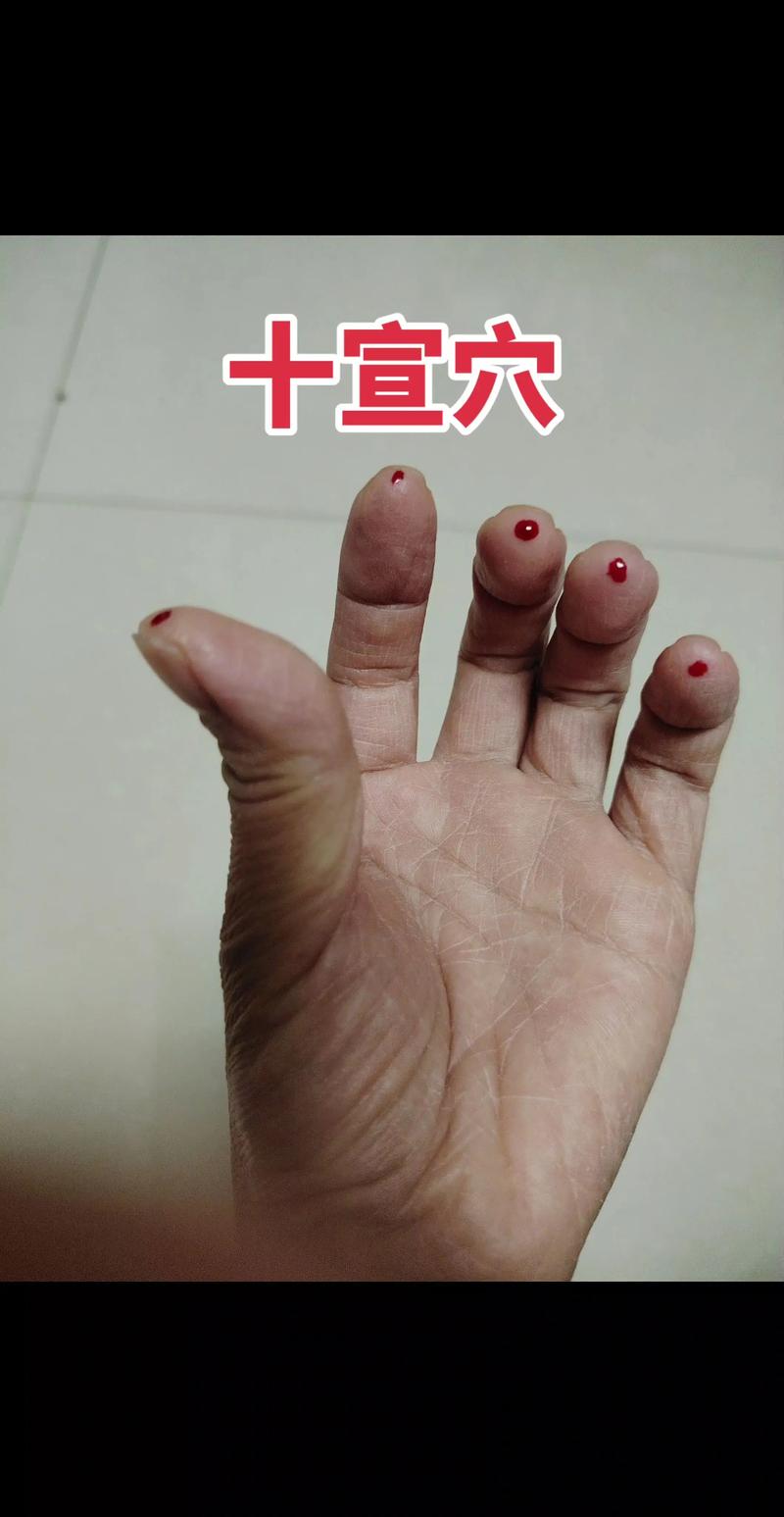 中暑头晕按什么穴位