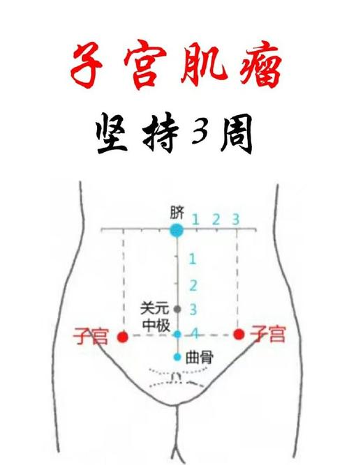 左边子宫穴位按压痛