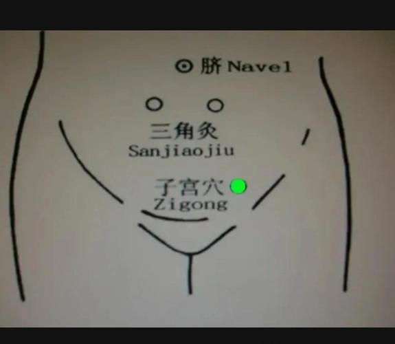 左边子宫穴位按压痛