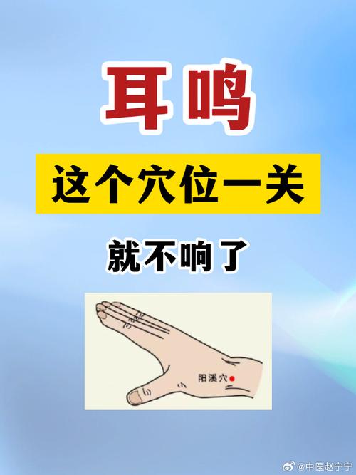 耳鸣针灸穴位有哪些