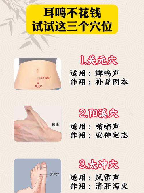 耳鸣针灸穴位有哪些