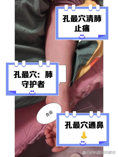 血栓流口水针炙穴位