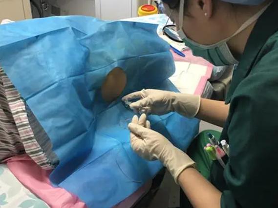 试管婴儿取卵后的饮食