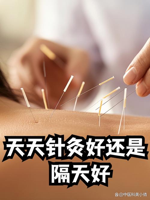 打完穴位打针疼多久