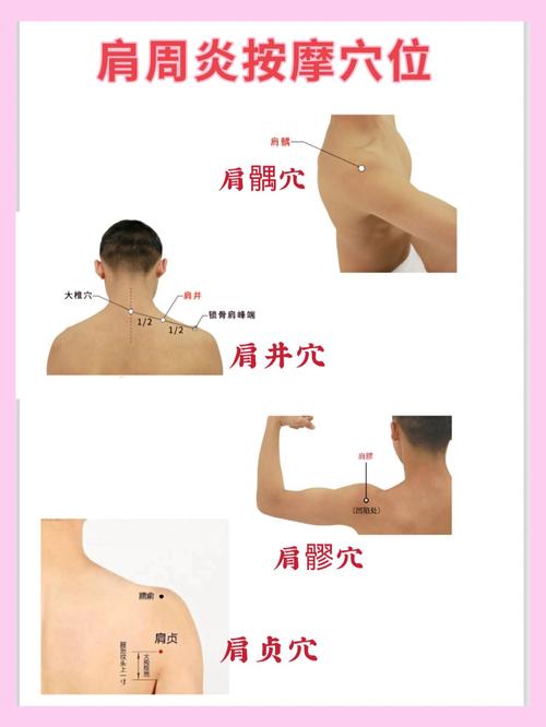 肩部疼痛按什么穴位