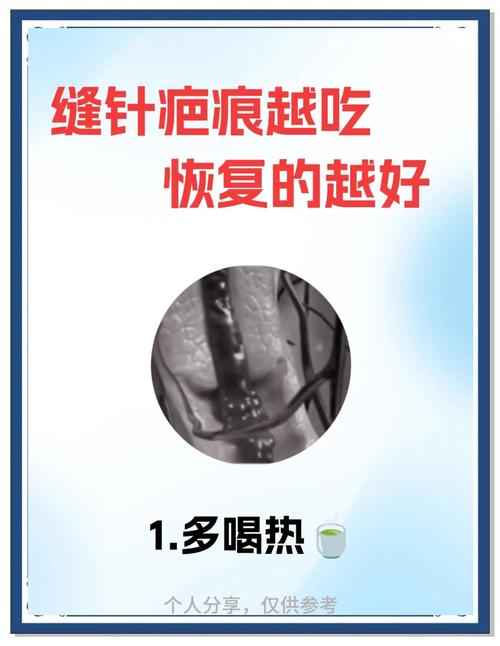 缝完针后饮食注意什么