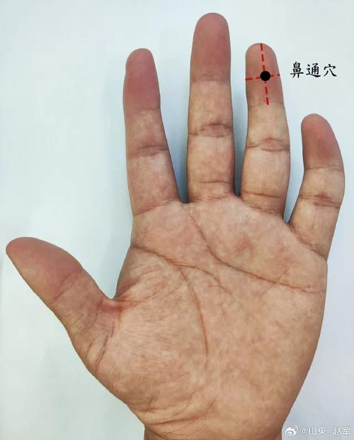 鼻子堵塞按手上穴位