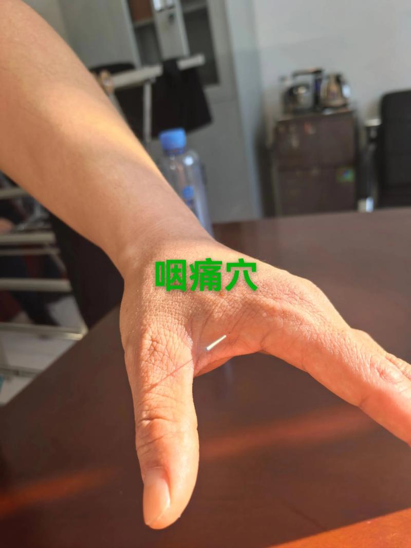 咽炎按摩哪个穴位好