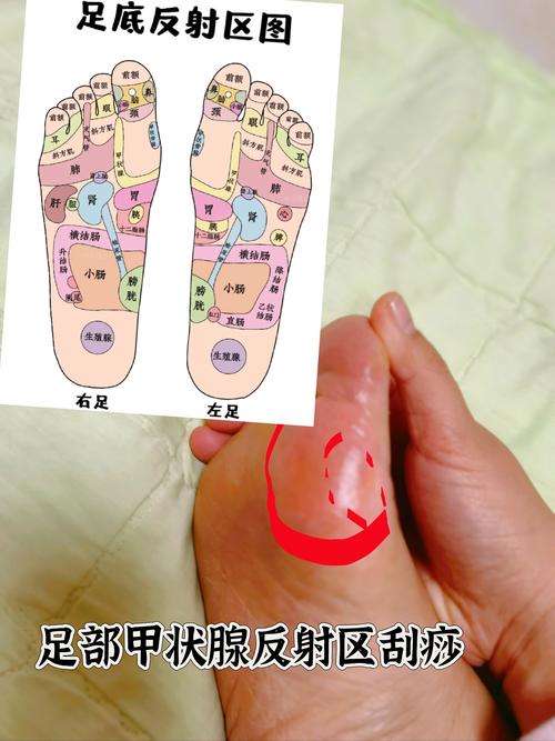 足部反射区穴位袜子