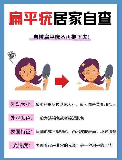 扁平疣的饮食注意事项